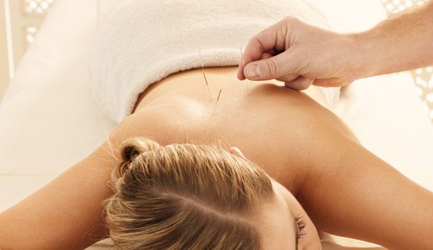 Dry Needling